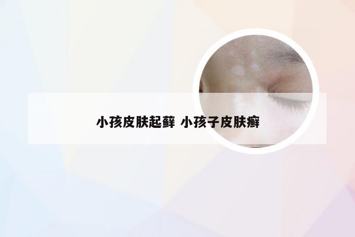 小孩皮肤起藓 小孩子皮肤癣