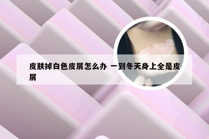 皮肤掉白色皮屑怎么办 一到冬天身上全是皮屑