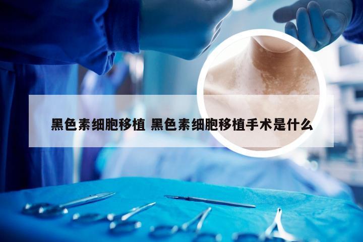 黑色素细胞移植 黑色素细胞移植手术是什么