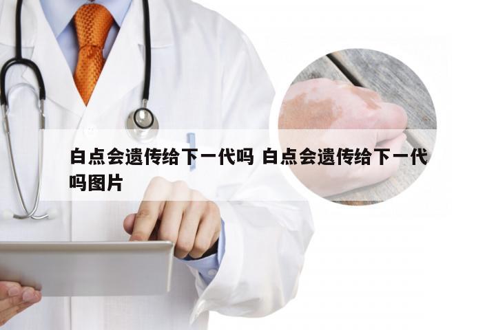 白点会遗传给下一代吗 白点会遗传给下一代吗图片