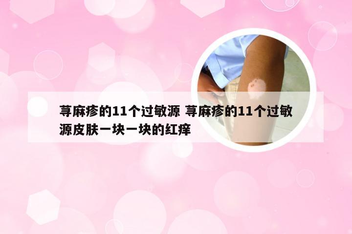荨麻疹的11个过敏源 荨麻疹的11个过敏源皮肤一块一块的红痒