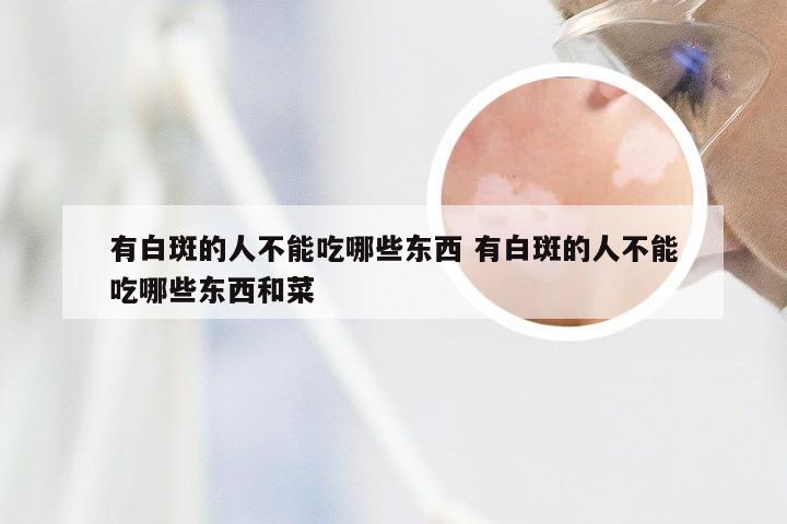 有白斑的人不能吃哪些东西 有白斑的人不能吃哪些东西和菜