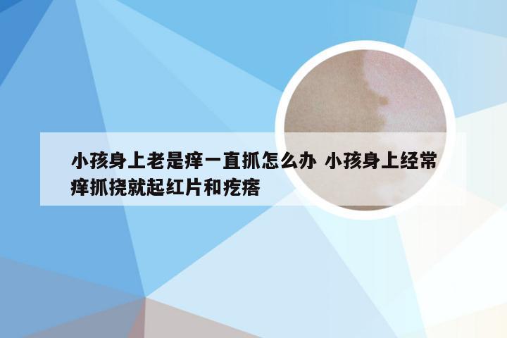 小孩身上老是痒一直抓怎么办 小孩身上经常痒抓挠就起红片和疙瘩