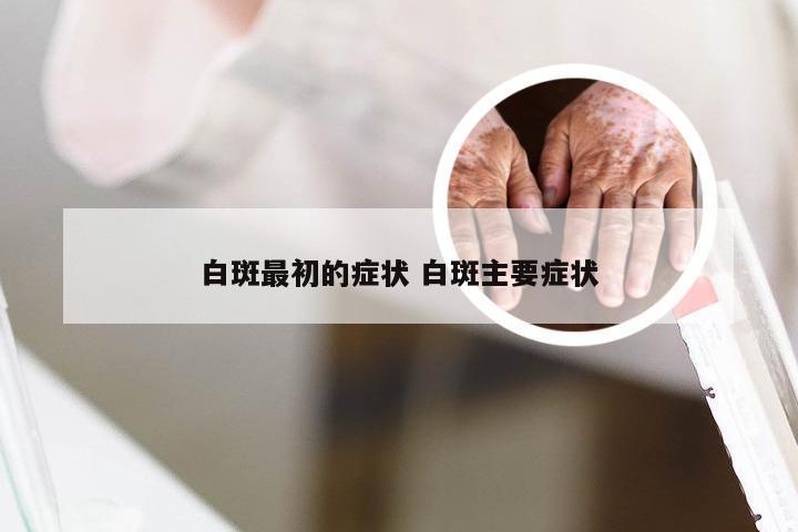 白斑最初的症状 白斑主要症状
