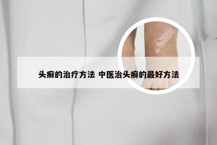 头癣的治疗方法 中医治头癣的最好方法