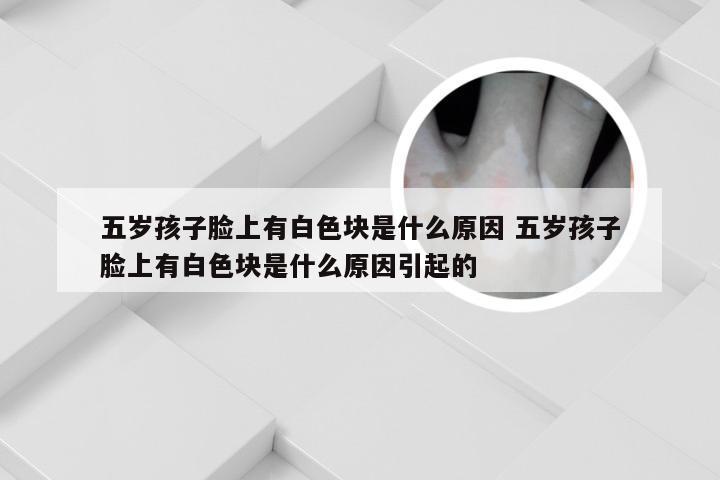 五岁孩子脸上有白色块是什么原因 五岁孩子脸上有白色块是什么原因引起的