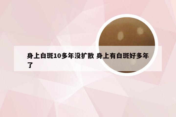 身上白斑10多年没扩散 身上有白斑好多年了