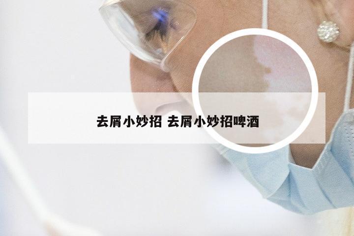 去屑小妙招 去屑小妙招啤酒