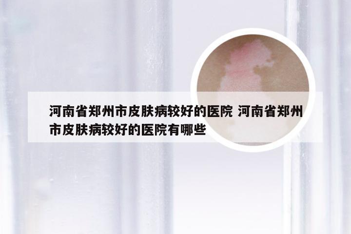 河南省郑州市皮肤病较好的医院 河南省郑州市皮肤病较好的医院有哪些