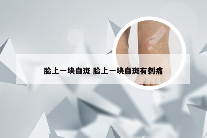 脸上一块白斑 脸上一块白斑有刺痛