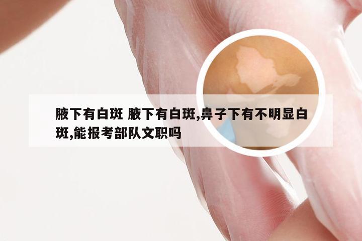 腋下有白斑 腋下有白斑,鼻子下有不明显白斑,能报考部队文职吗