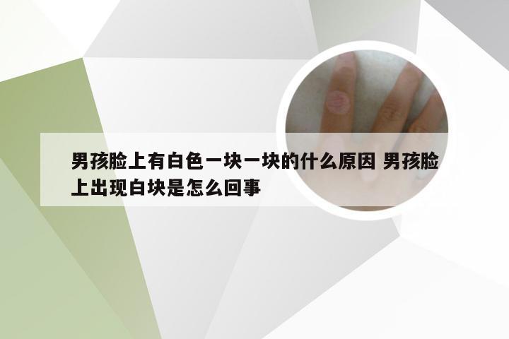 男孩脸上有白色一块一块的什么原因 男孩脸上出现白块是怎么回事