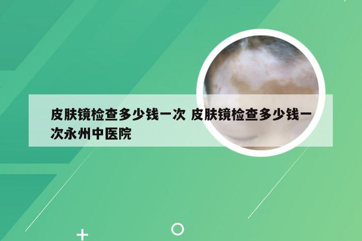 皮肤镜检查多少钱一次 皮肤镜检查多少钱一次永州中医院