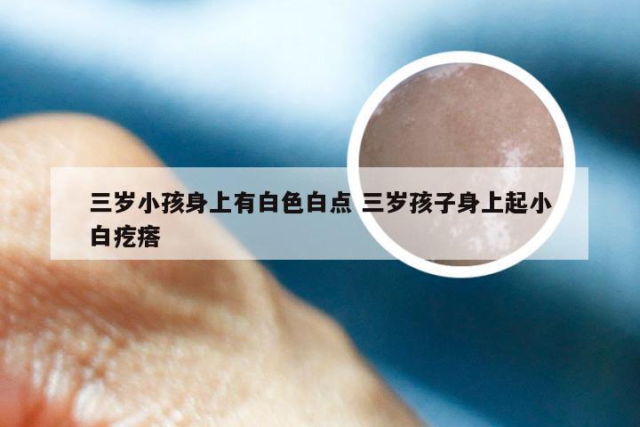 三岁小孩身上有白色白点 三岁孩子身上起小白疙瘩