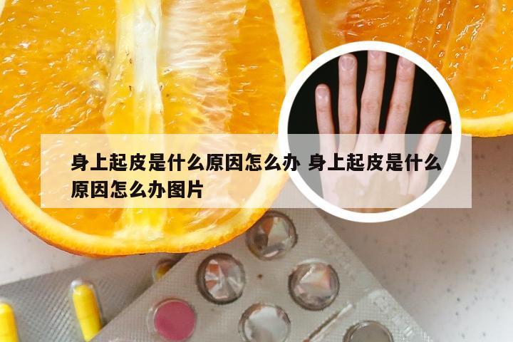 身上起皮是什么原因怎么办 身上起皮是什么原因怎么办图片