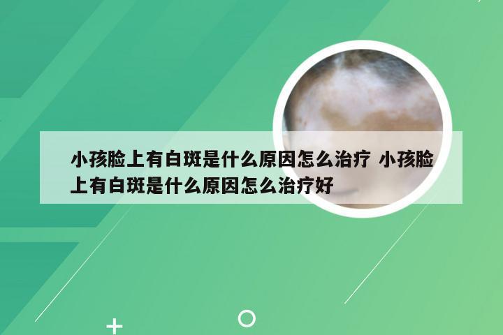 小孩脸上有白斑是什么原因怎么治疗 小孩脸上有白斑是什么原因怎么治疗好