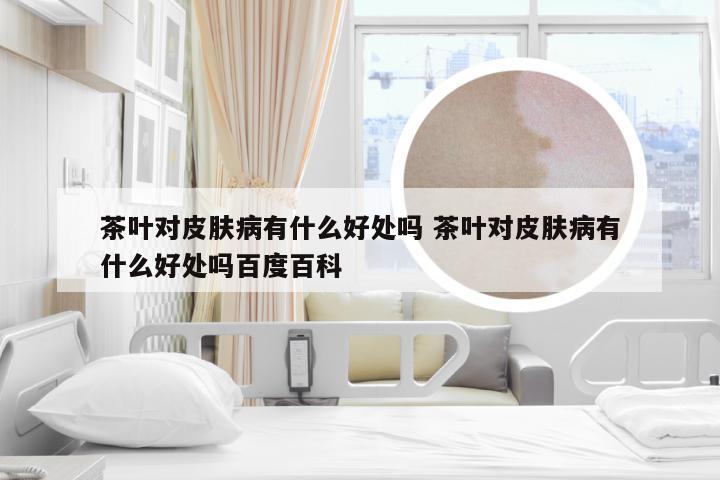 茶叶对皮肤病有什么好处吗 茶叶对皮肤病有什么好处吗百度百科