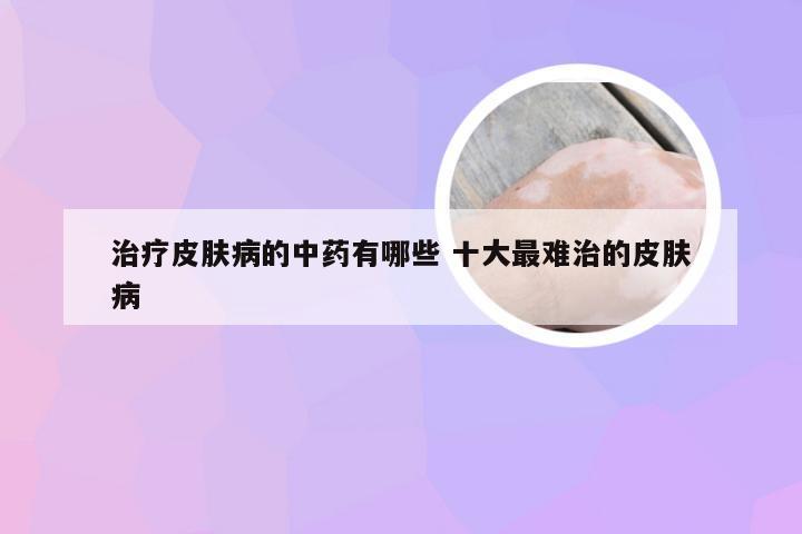 治疗皮肤病的中药有哪些 十大最难治的皮肤病