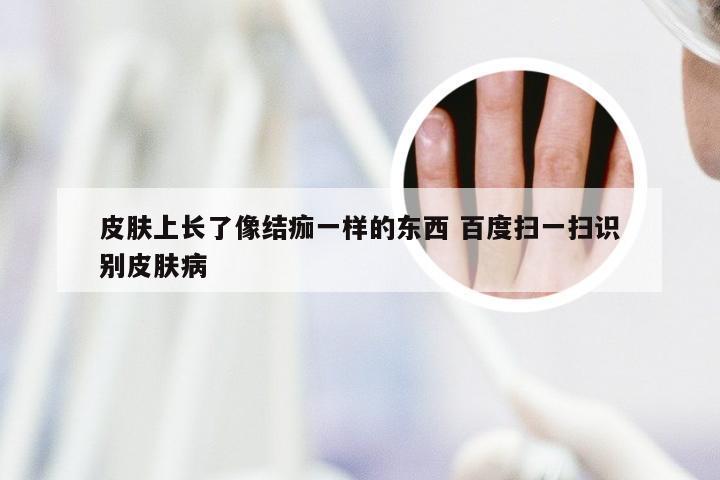皮肤上长了像结痂一样的东西 百度扫一扫识别皮肤病