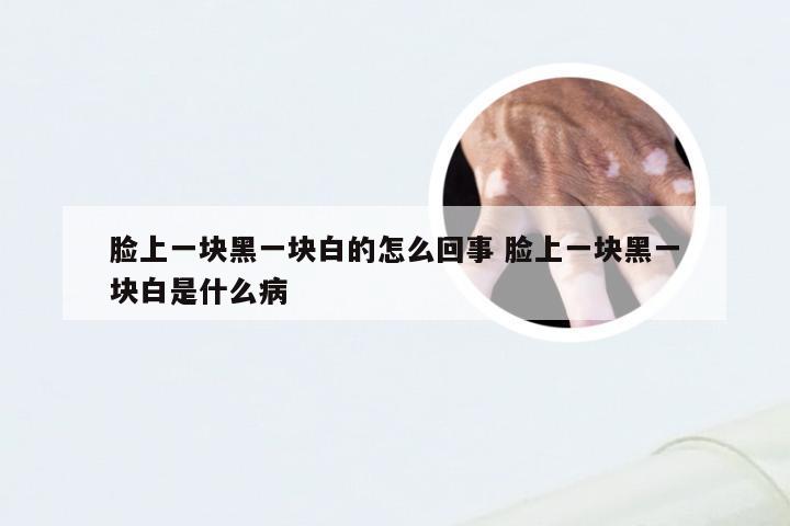 脸上一块黑一块白的怎么回事 脸上一块黑一块白是什么病