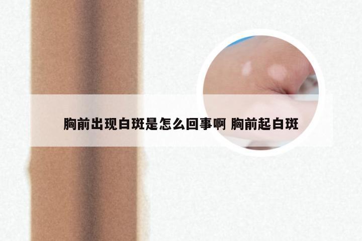 胸前出现白斑是怎么回事啊 胸前起白斑