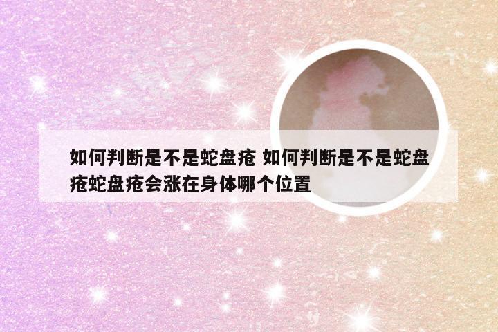 如何判断是不是蛇盘疮 如何判断是不是蛇盘疮蛇盘疮会涨在身体哪个位置