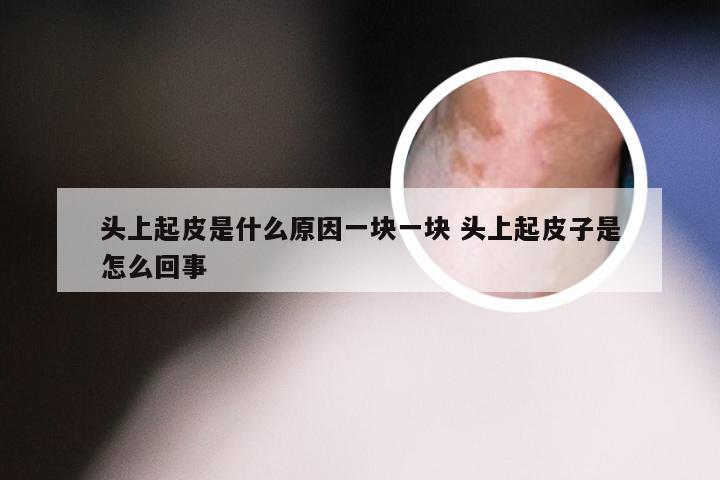 头上起皮是什么原因一块一块 头上起皮子是怎么回事