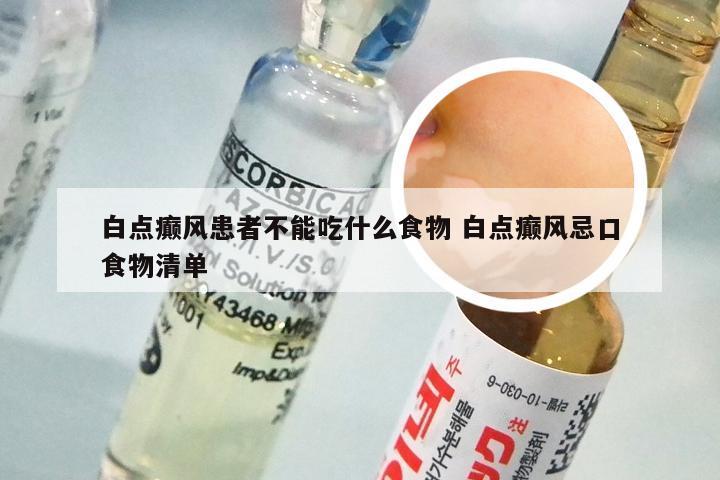 白点癫风患者不能吃什么食物 白点癫风忌口食物清单