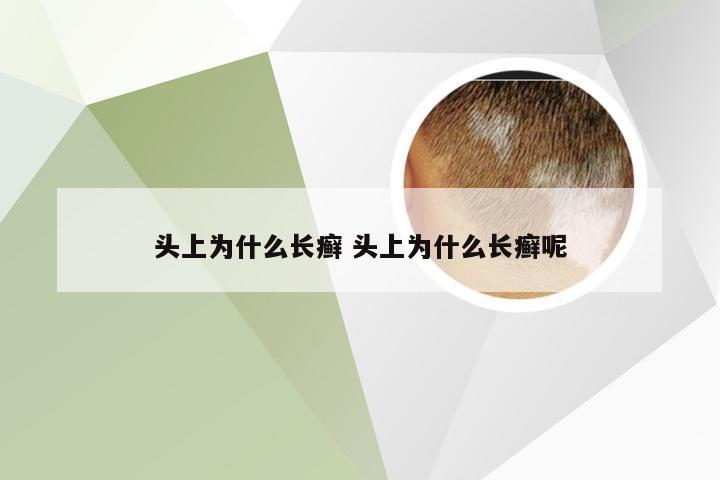 头上为什么长癣 头上为什么长癣呢