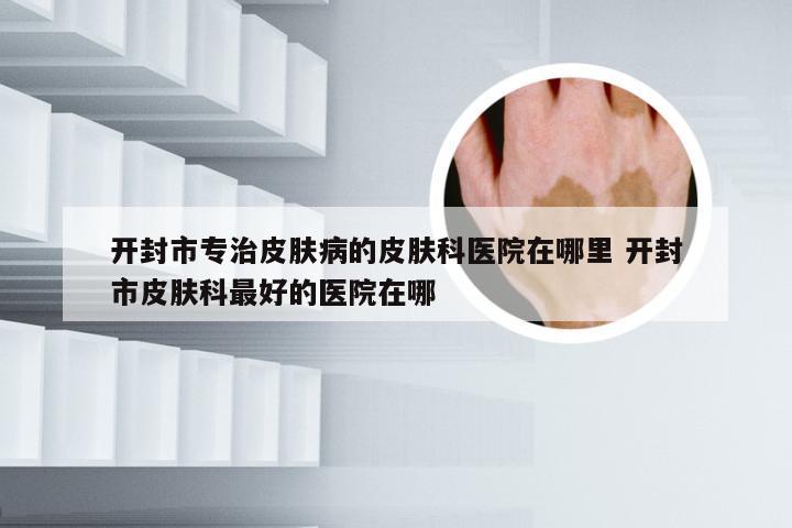 开封市专治皮肤病的皮肤科医院在哪里 开封市皮肤科最好的医院在哪