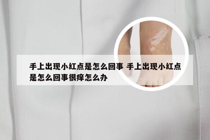 手上出现小红点是怎么回事 手上出现小红点是怎么回事很痒怎么办