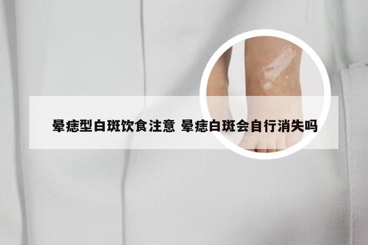 晕痣型白斑饮食注意 晕痣白斑会自行消失吗
