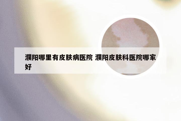 濮阳哪里有皮肤病医院 濮阳皮肤科医院哪家好