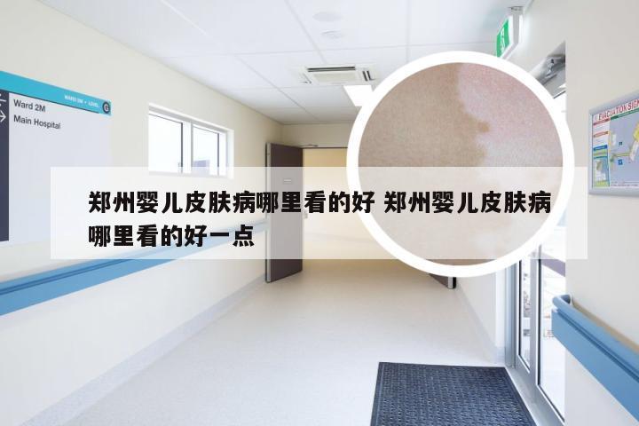 郑州婴儿皮肤病哪里看的好 郑州婴儿皮肤病哪里看的好一点