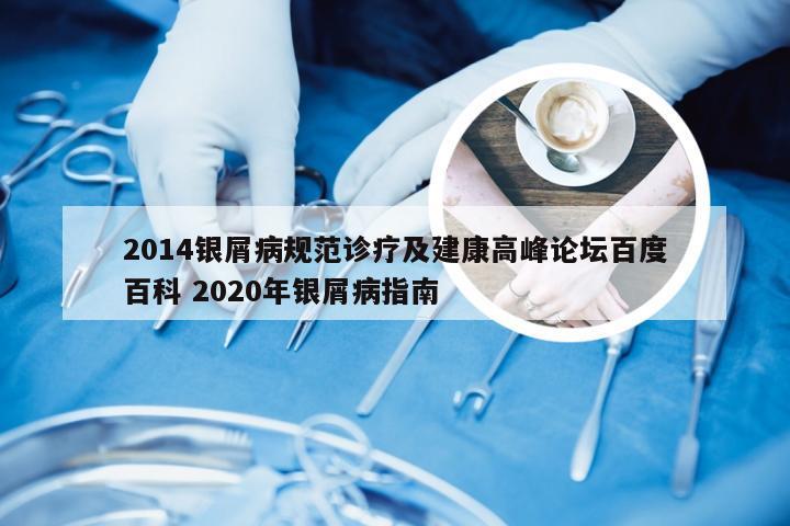 2014银屑病规范诊疗及建康高峰论坛百度百科 2020年银屑病指南