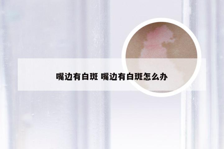 嘴边有白斑 嘴边有白斑怎么办