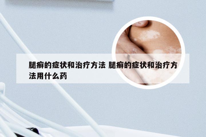 腿癣的症状和治疗方法 腿癣的症状和治疗方法用什么药