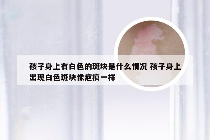 孩子身上有白色的斑块是什么情况 孩子身上出现白色斑块像疤痕一样