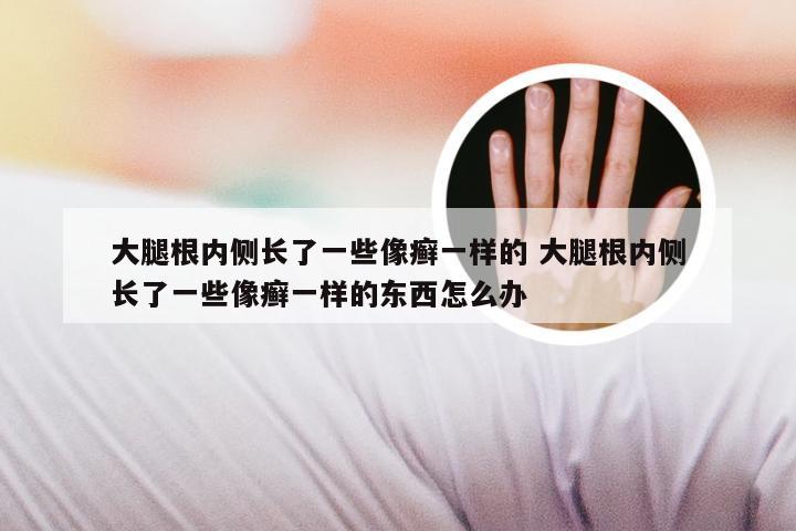 大腿根内侧长了一些像癣一样的 大腿根内侧长了一些像癣一样的东西怎么办