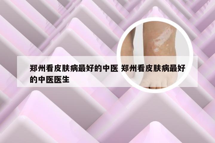 郑州看皮肤病最好的中医 郑州看皮肤病最好的中医医生