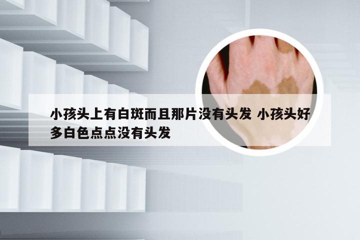 小孩头上有白斑而且那片没有头发 小孩头好多白色点点没有头发