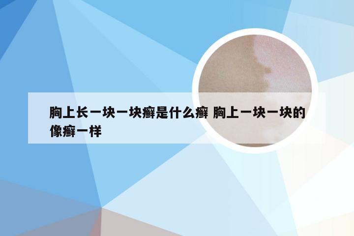 胸上长一块一块癣是什么癣 胸上一块一块的像癣一样