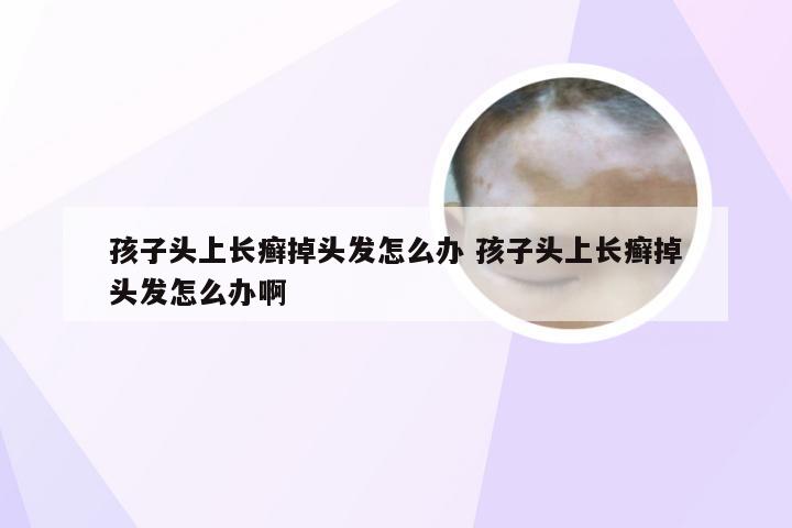 孩子头上长癣掉头发怎么办 孩子头上长癣掉头发怎么办啊