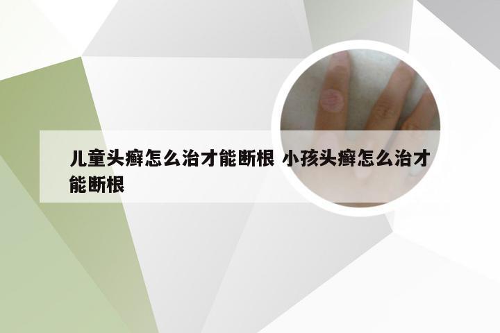 儿童头癣怎么治才能断根 小孩头癣怎么治才能断根