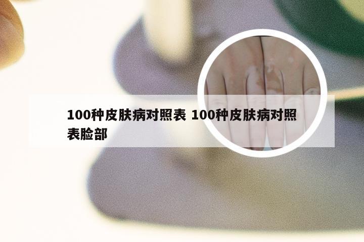 100种皮肤病对照表 100种皮肤病对照表脸部