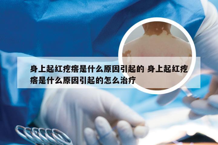 身上起红疙瘩是什么原因引起的 身上起红疙瘩是什么原因引起的怎么治疗