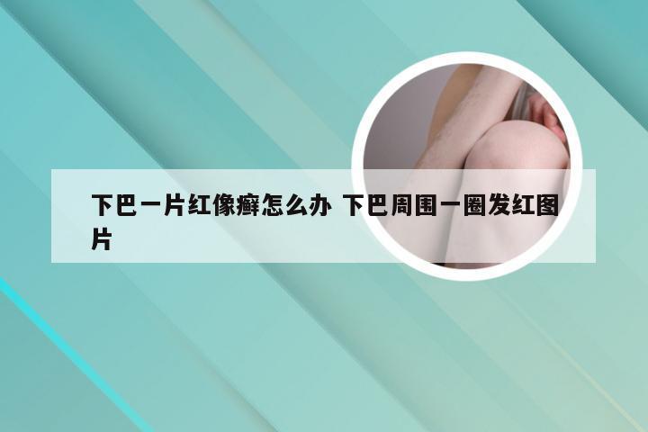 下巴一片红像癣怎么办 下巴周围一圈发红图片