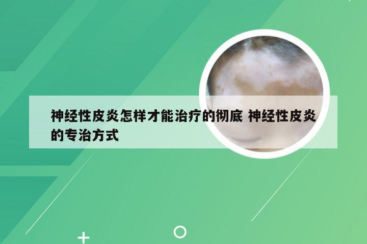 神经性皮炎怎样才能治疗的彻底 神经性皮炎的专治方式