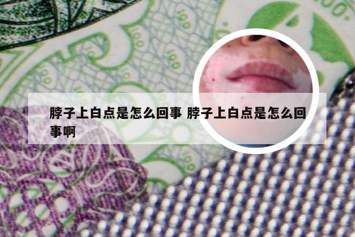 脖子上白点是怎么回事 脖子上白点是怎么回事啊