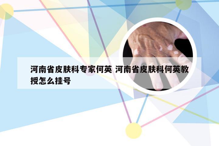 河南省皮肤科专家何英 河南省皮肤科何英教授怎么挂号